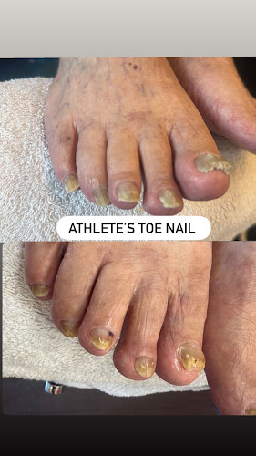 9am Beauty Salon (ingrown/fungus/infection)