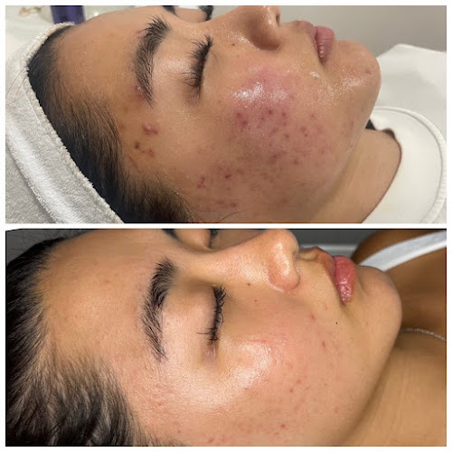 Silk Touch Laser Hair Removal, Massages, Facial& Nails