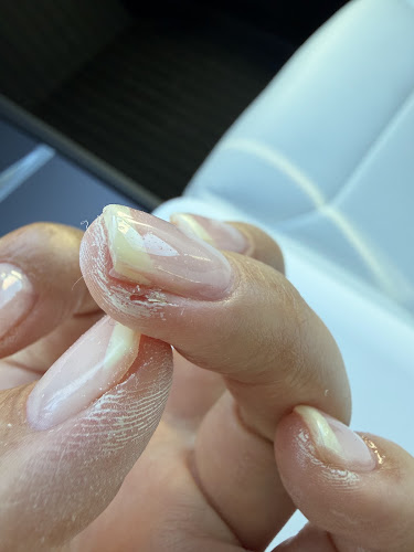 Torrance T Nails