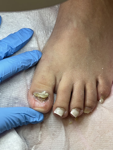 The Toe Surgeon