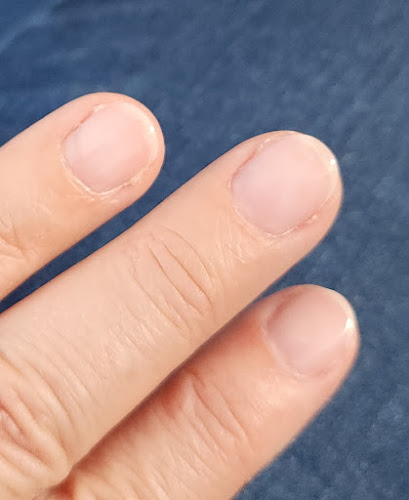 Les Ongles de l'Île