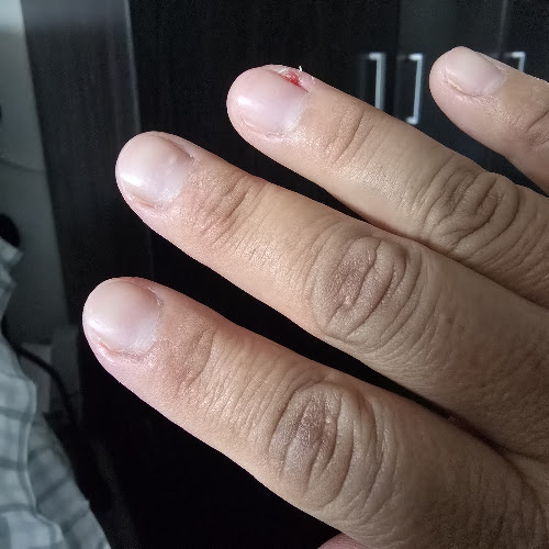 Ongles Perfecto