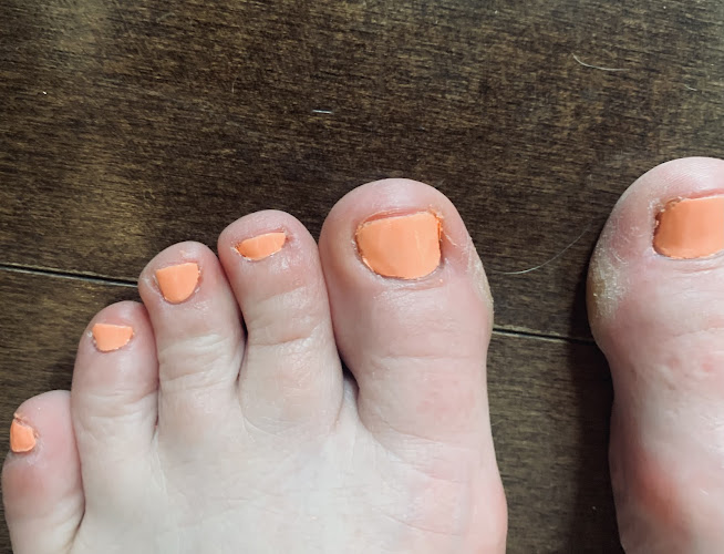 Pro Ongles