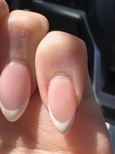 Tony pro-ongles